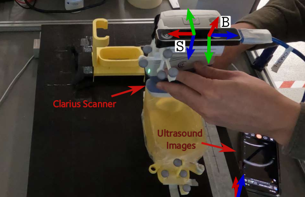 Ultrasound Device
